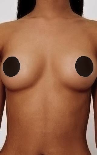 Reusable Nipple Silicon Pads - Swank A Posh